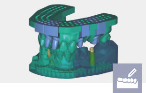 Exocad Module Autonome Modèle - abonnemment mensuel