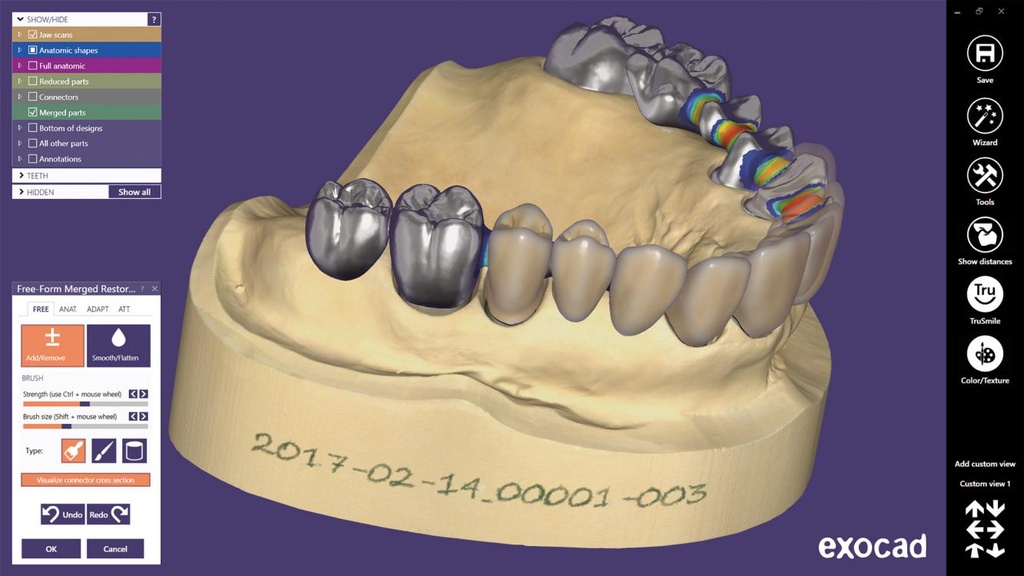 Exocad DentalCAD Standard- abonnement annuel