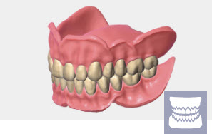 Exocad Module Full Denture - abonnement annuel