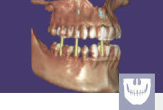 Exocad Module Dicom visualiseur - abonnement annuel