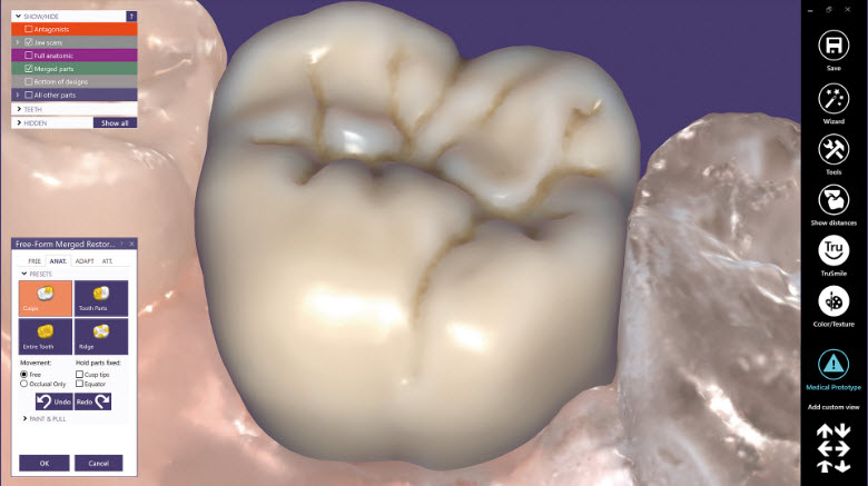 Exocad ChairsideCAD Standard - abonnement mensuel (36 mois)