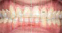 [EXO-ADDON-SMIL-FLEX-M] Exocad Module Smile Creator - abonnemment mensuel