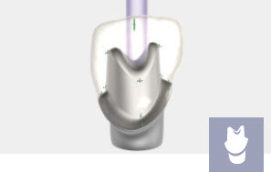 [EXO-ADDON-IMPLA-PERP] Exocad Module Implant - perpetuel